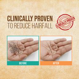 Indulekha Bringha Oil, Reduces Hair Fall And Grows New Hair, 100% Ayurvedic Oil, 100ml