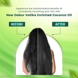 Dabur Vatika Enriched Coconut Hair Oil - 300ml | For Strong, Thick & Shiny Hair | Clinically Tested to Reduce 90% Hairfall in 4 Weeks | Prevents Dull & Damaged Hair | Enriched with 10 Herbs